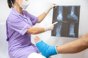 Joint Replacement Surgery: What You Need to Know